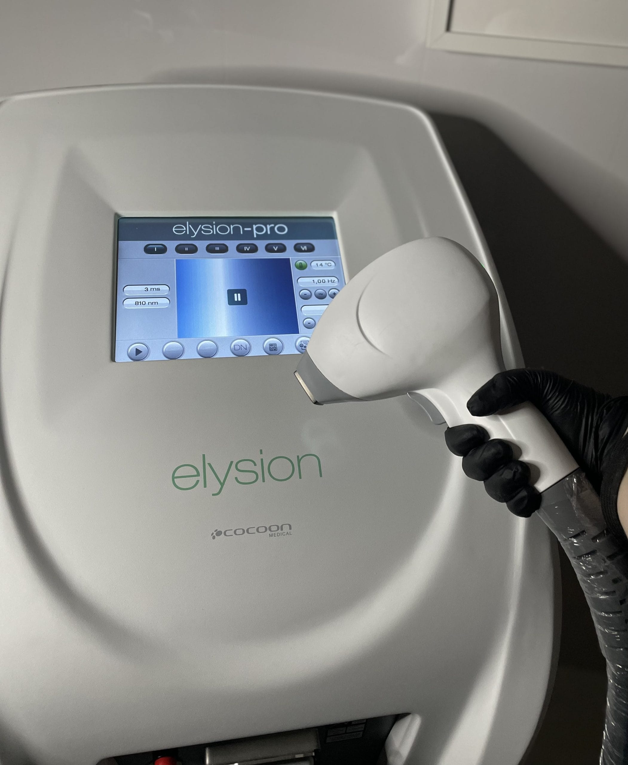 Laser hair removal